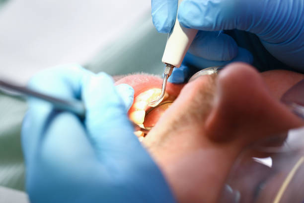 Best Emergency Root Canal Therapy in Prosperity, SC