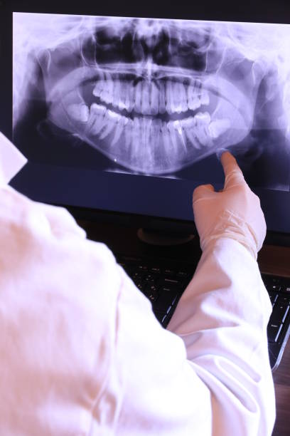 Best Knocked-Out Tooth (Avulsed Tooth) Treatment in Prosperity, SC